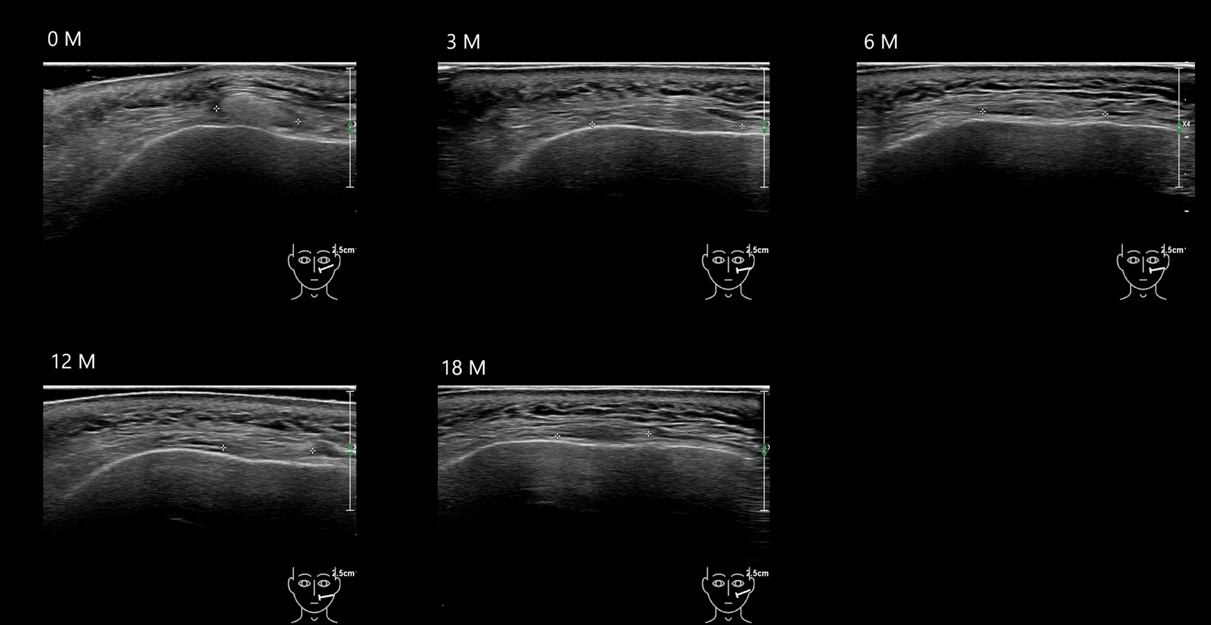 caha 10b e - Image 4