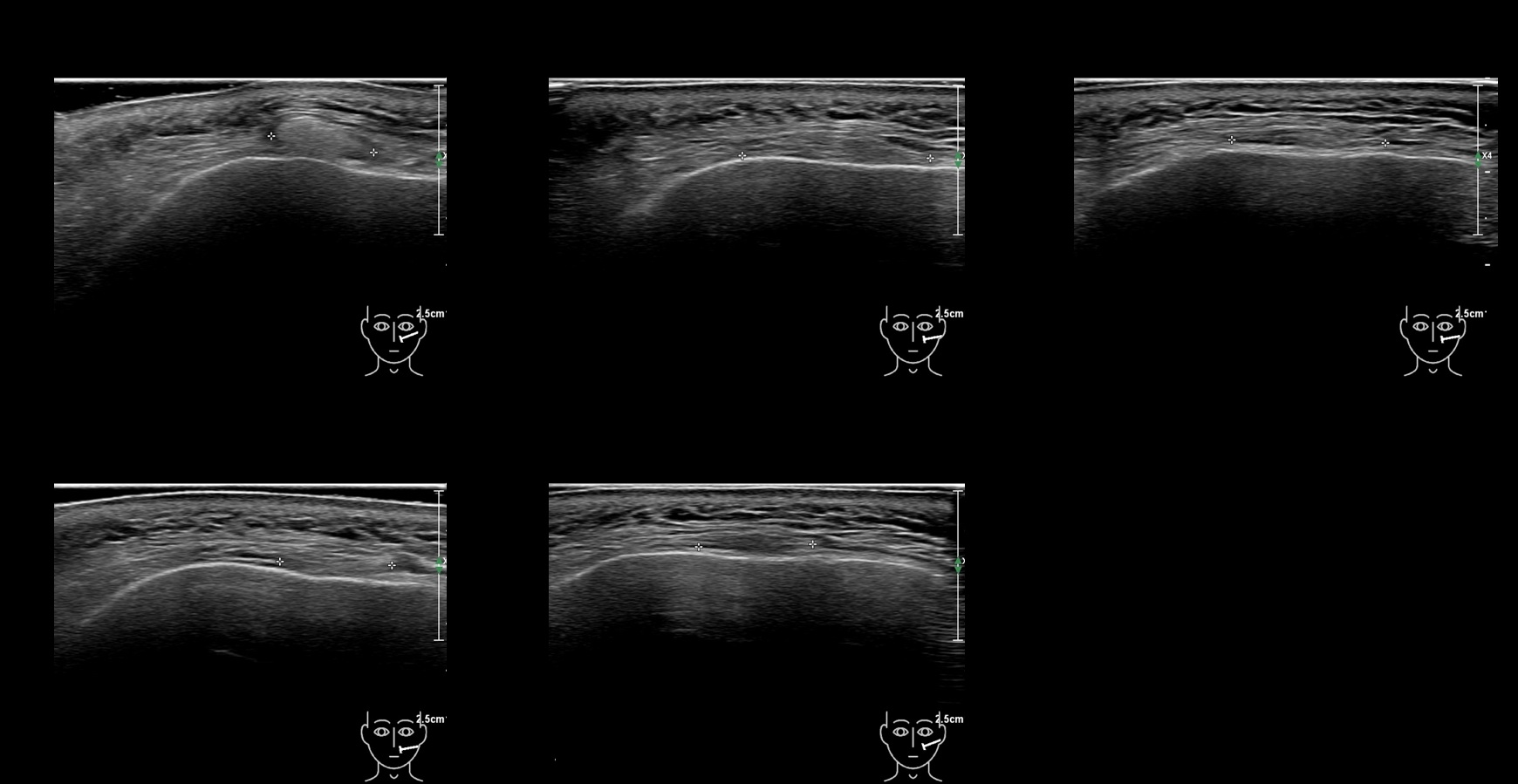 caha 10b e - Image 2