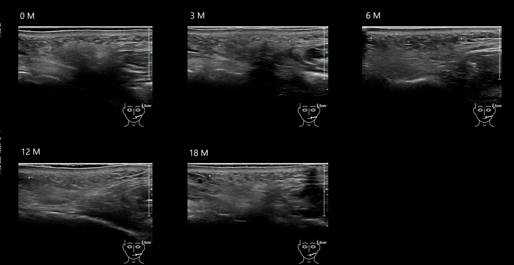 O CAHA11 E - Image 2