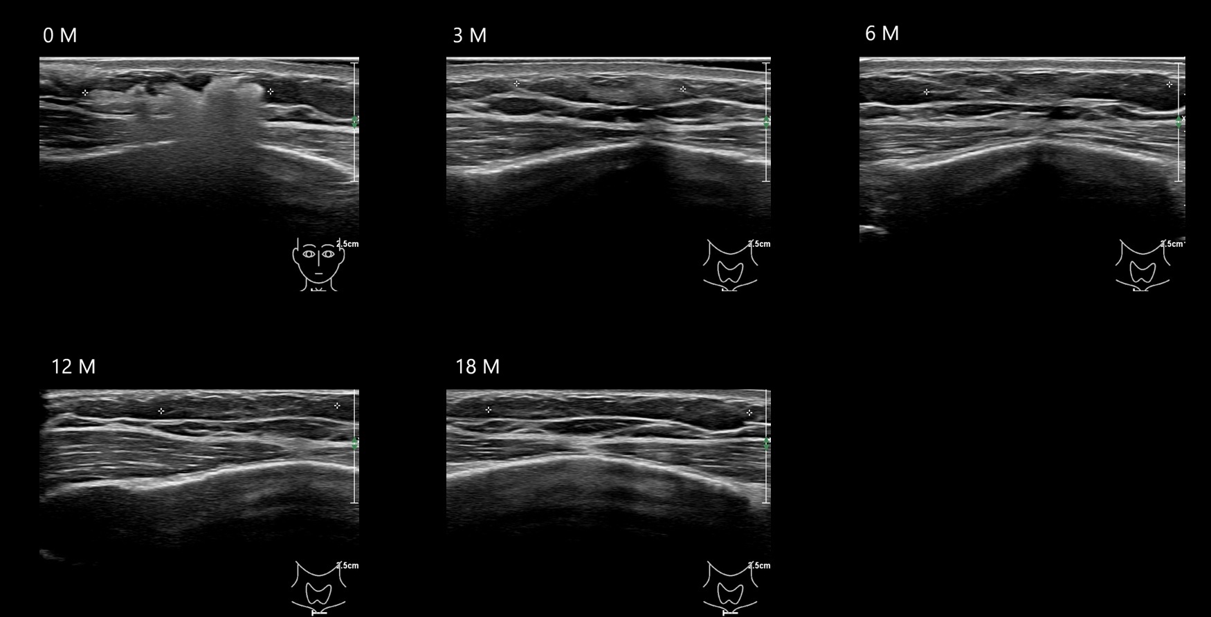 O CAHA12 E - Image 2