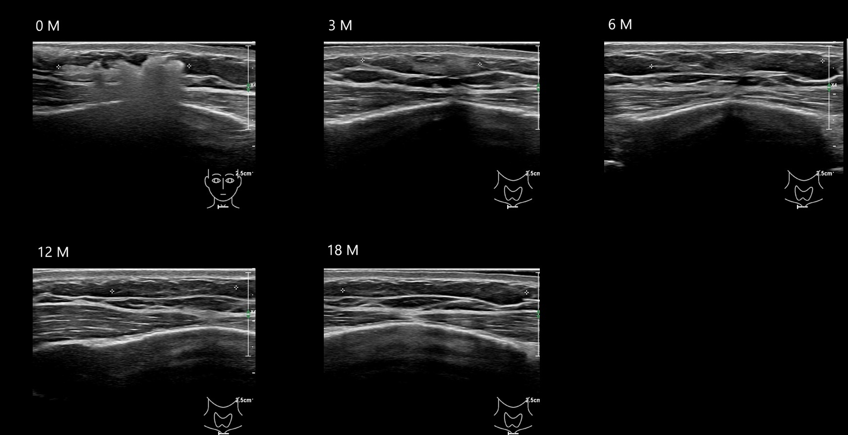 O CAHA13 E - Image 2