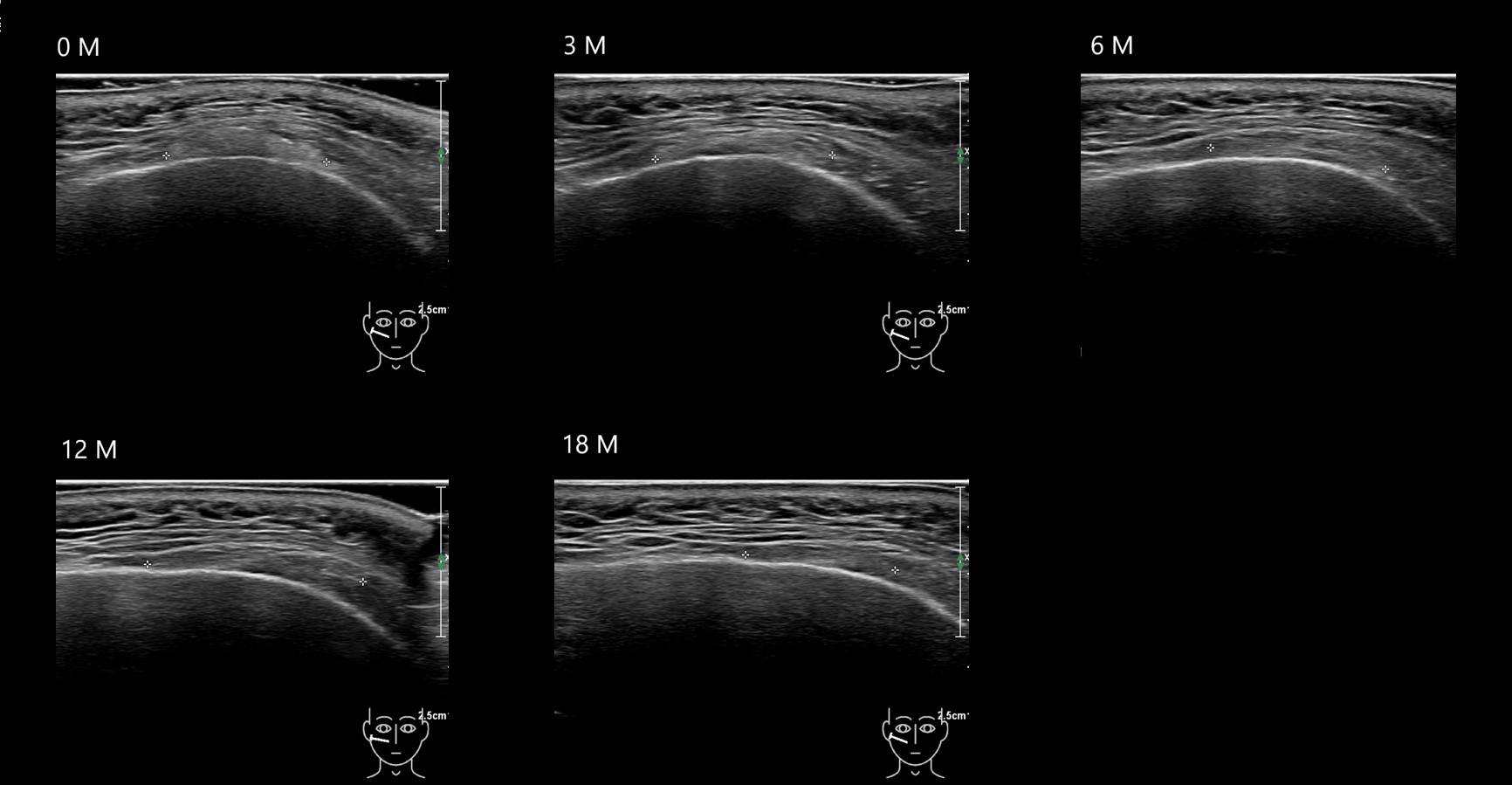 caha 14b e - Image 4