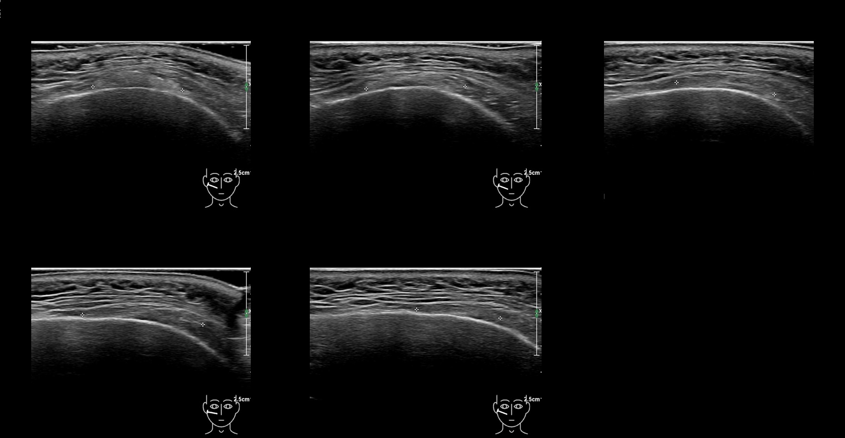 caha 14b e - Image 2