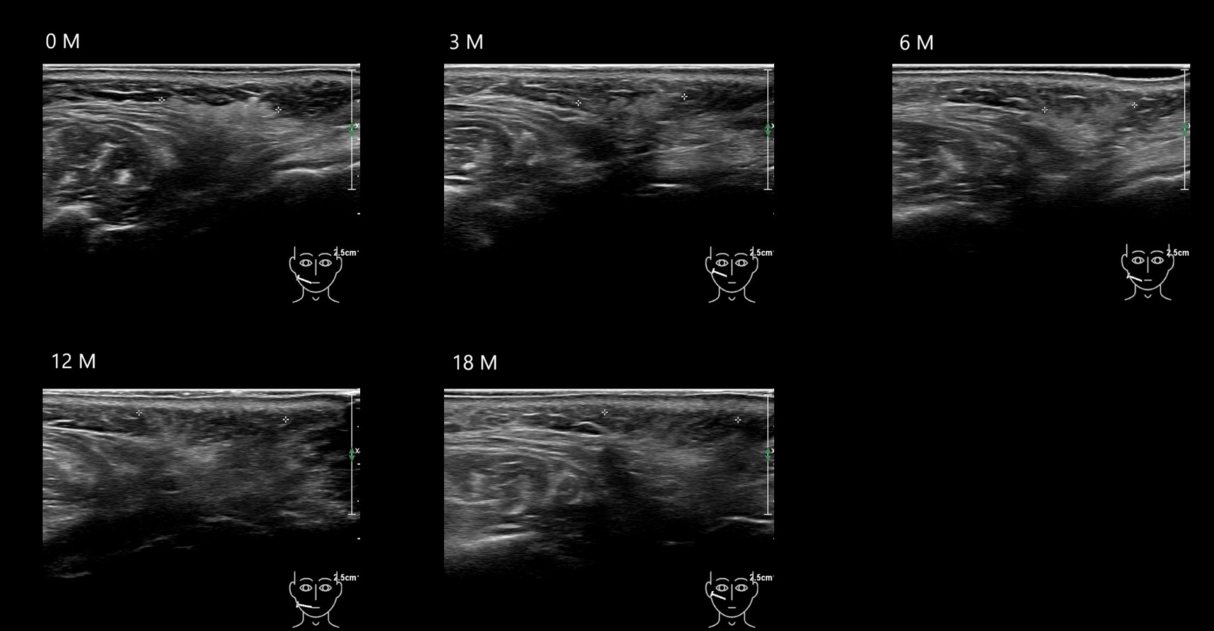 caha 15b e - Image 4