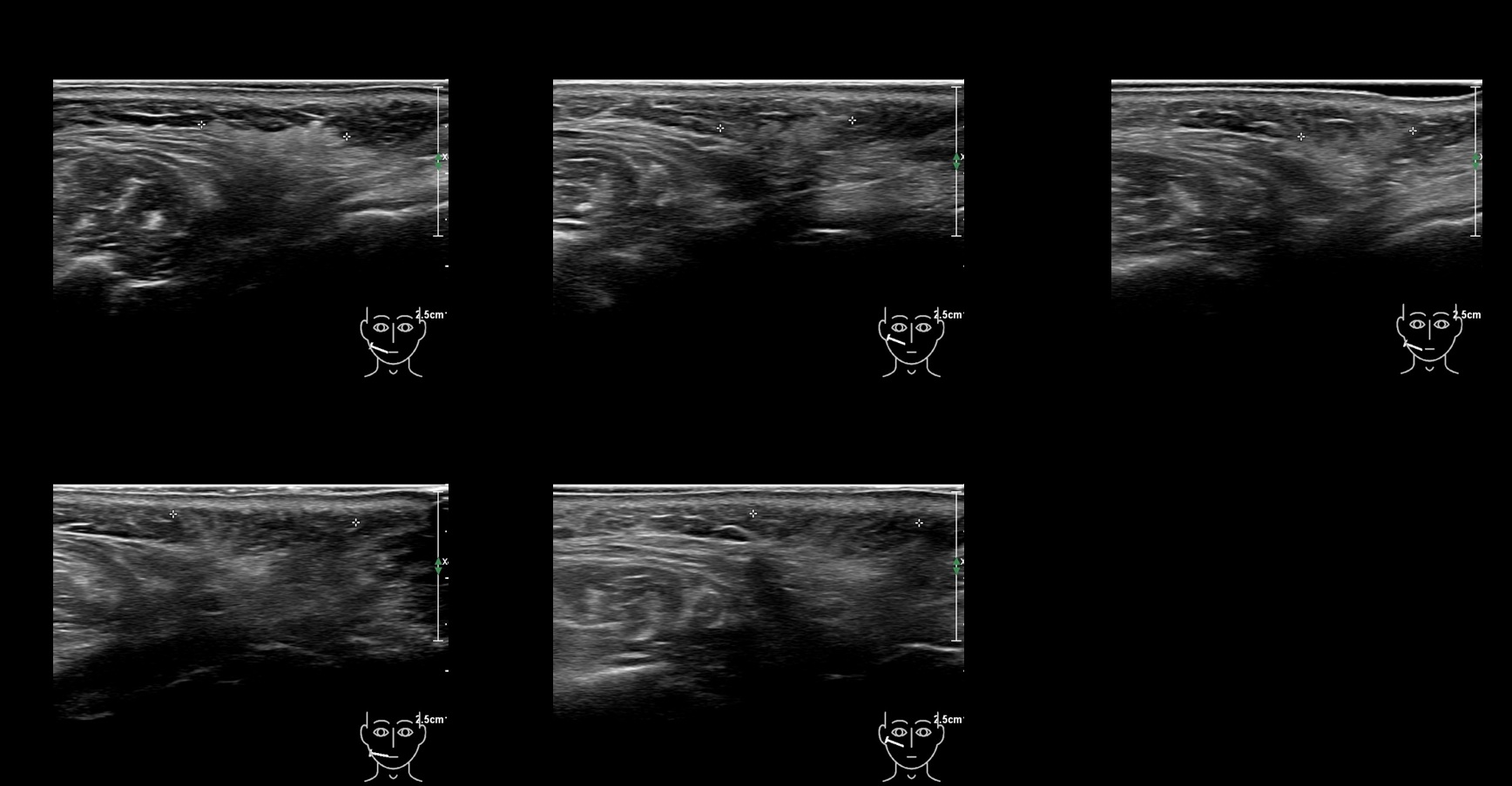caha 15b e - Image 2