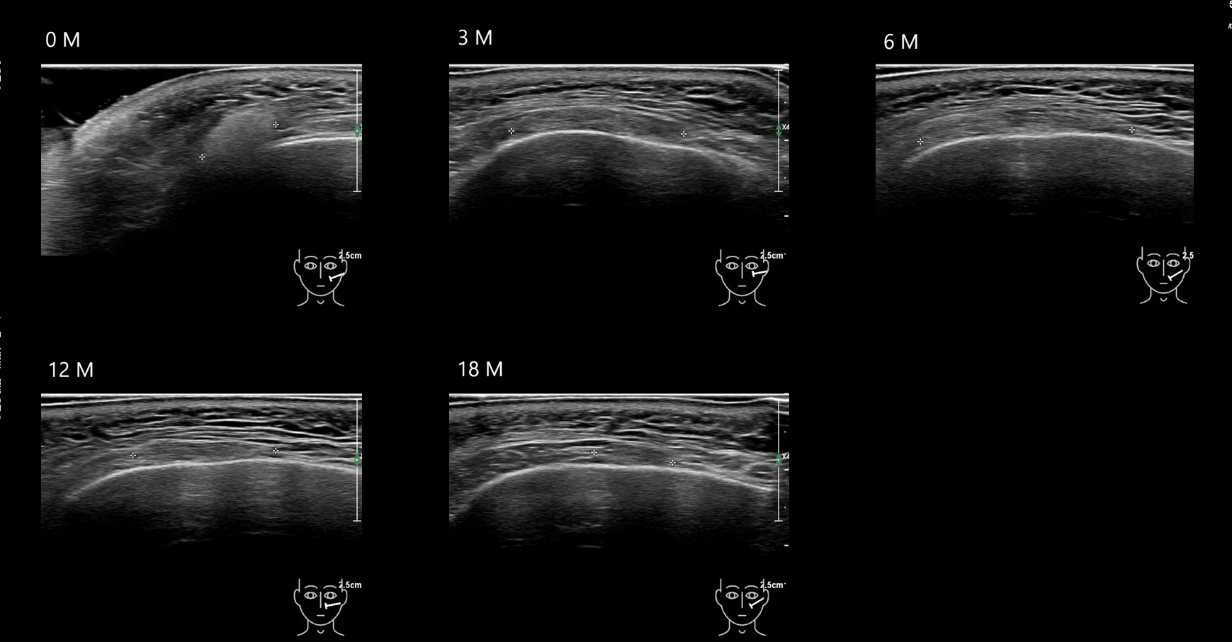 O CAHA16 E - Image 2
