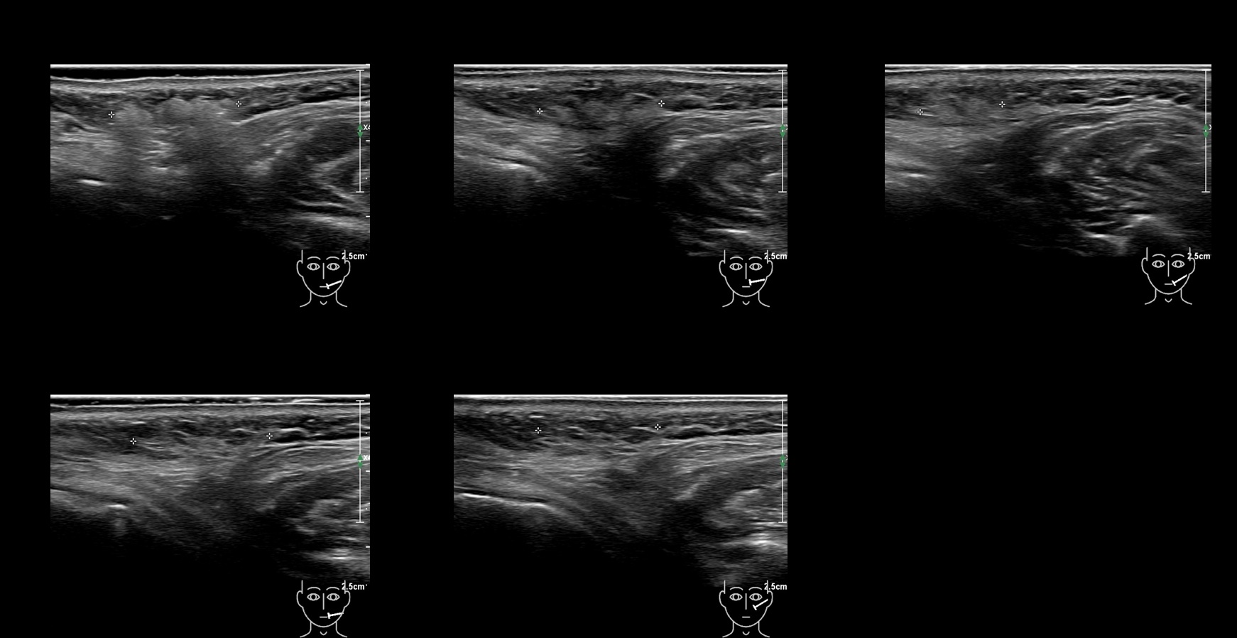 caha 17b e - Image 2