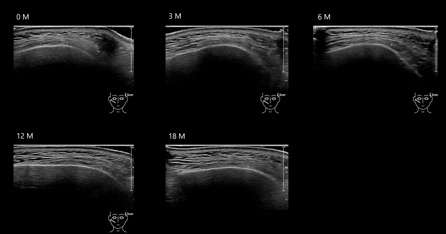 caha 19b e - Image 4