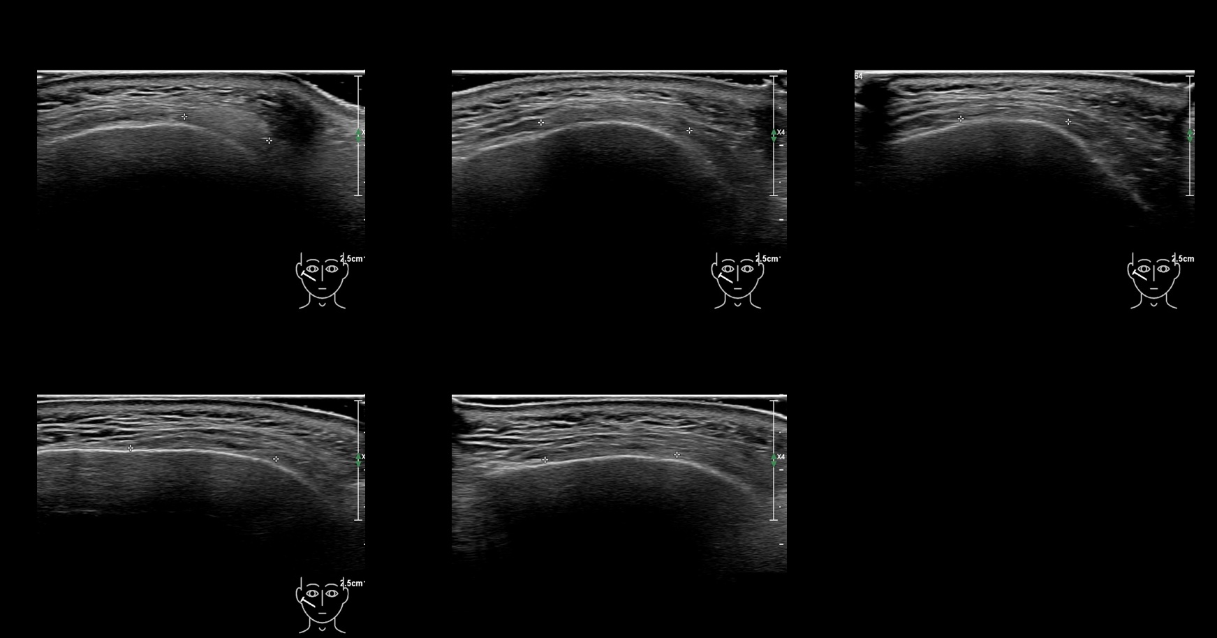 caha 19b e - Image 2