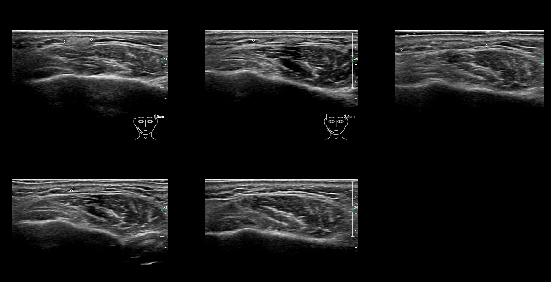 HAca 11b e - Image 2