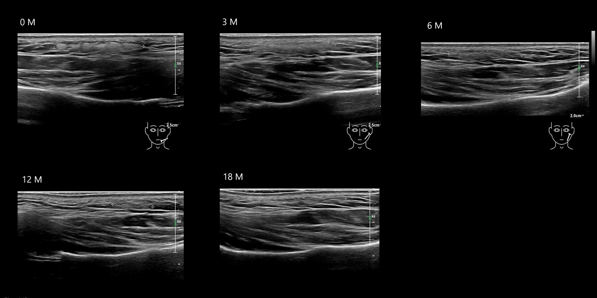 HAca 16b e - Image 4