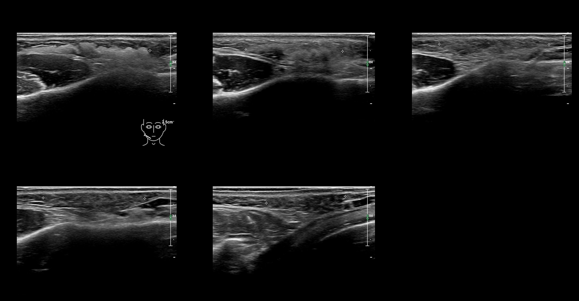 HAca 17b e - Image 2