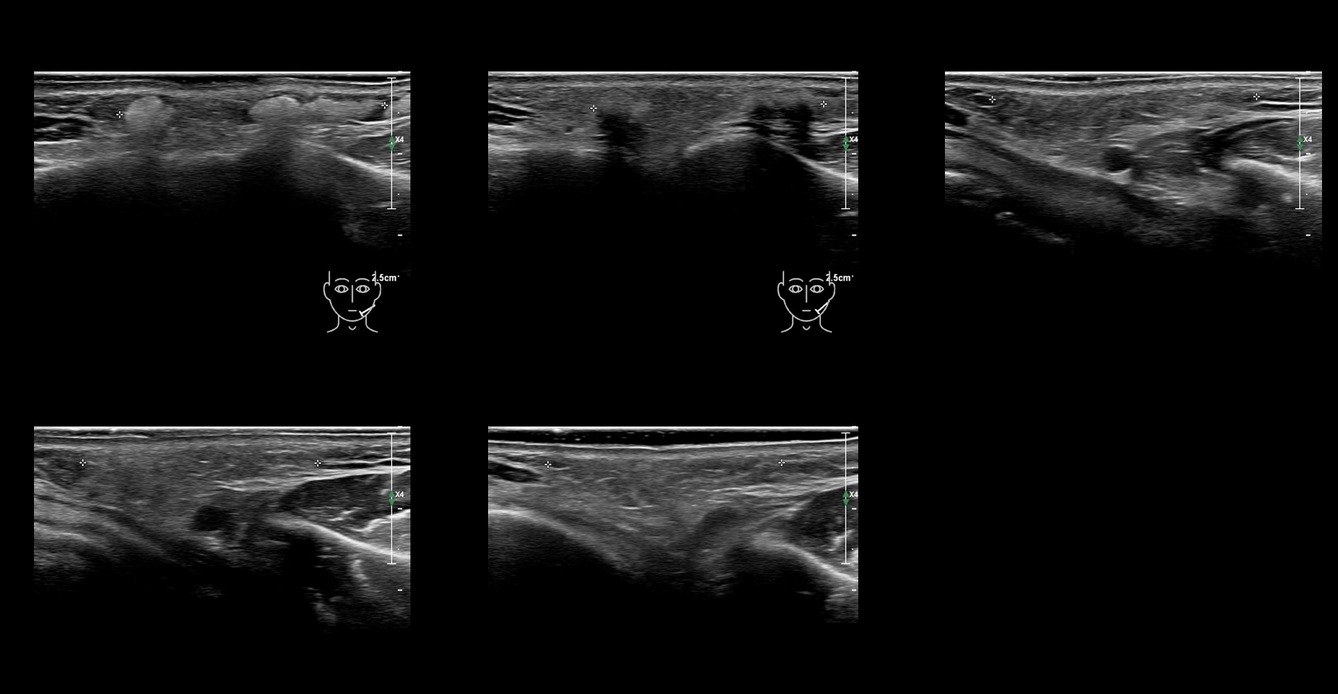 HAca 18b e - Image 2